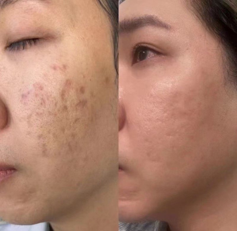 湛江医美新趋势：美丽背后的智慧选择