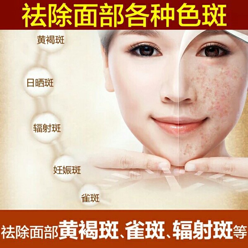 玻尿酸注射：为肌肤注入满满活力与年轻的秘密